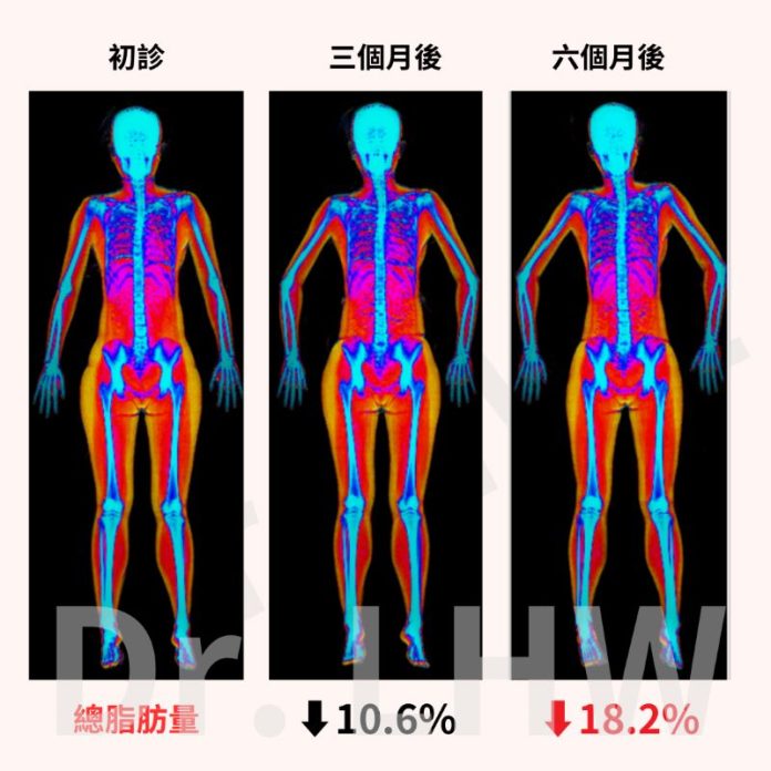 (圖／示意圖)